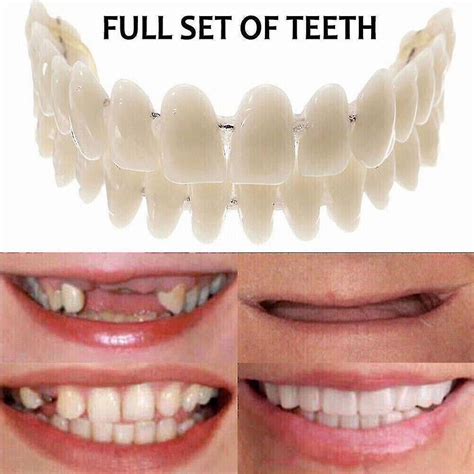fake teeth cover price